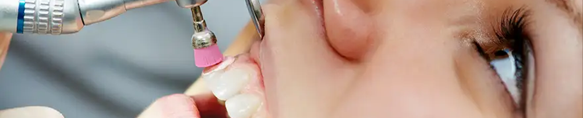 دندانپزشکی زیبایی در کرج