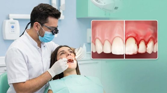 علائم عفونت لثه چیست؟ علت، درمان و زمان مراجعه