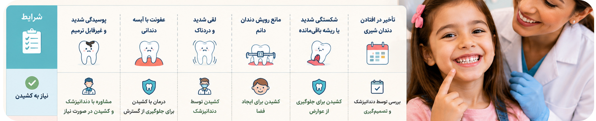 کشیدن دندان شیری کودک